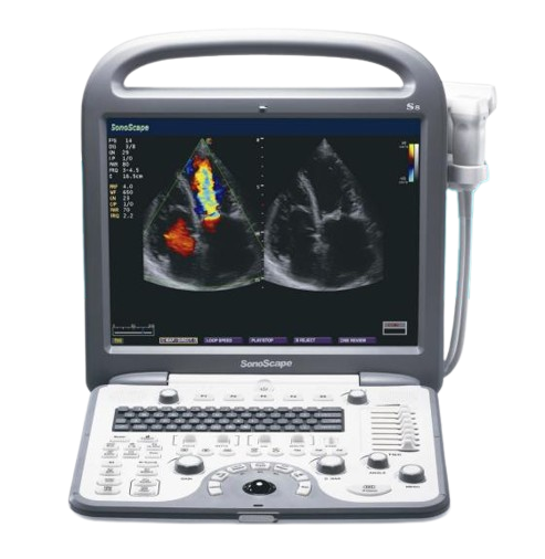 Máy siêu âm xách tay SonoScape S8